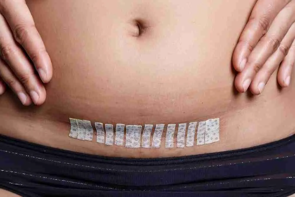 La salud mental en la maternidad